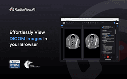 RadioView.AI - Chrome Extension